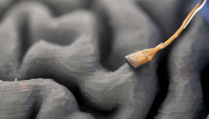 3d model of brain connection